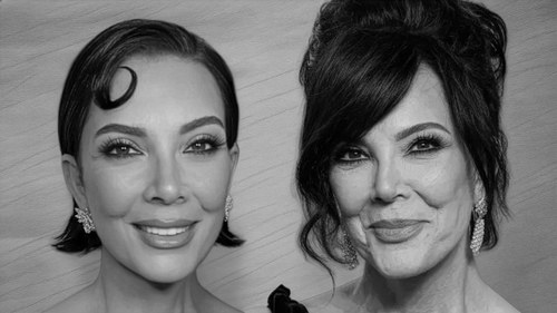 Kris Jenner facelift before and after, greyscale comparison reviewed by Dr. Frank Agullo, MD, FACS, double board-certified plastic surgeon in El Paso, Texas