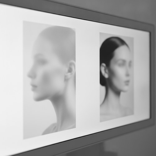 Black and white editorial comparison of two portraits side by side. Aesthetic analysis commentary by Dr. Frank Agullo, MD, FACS.