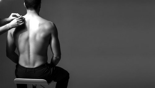 Black and white editorial photograph for trapezius implant removal commentary by Dr. Frank Agullo, MD, FACS.