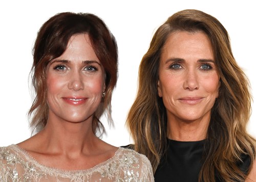 Side by side photos of Kristen Wiig, in 2013 on the left with auburn hair pinned up, and in 2026 on the right with long highlighted brown hair. Commentary by Frank Agullo, MD, FACS.